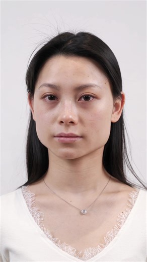 幼态脸babyface#beauty#beforeandafter#幼态脸#变美##antiaging