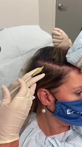 Here’s a behind the scenes look at a Platelet Rich Plasma (PRP)...