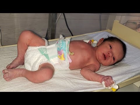 knowledge of NICU is live!#Live #baby#cute