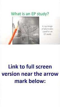 What is an EP study?