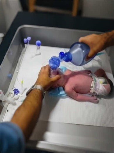 Emotional Birth Story: Baby Delivered by NVD With Delayed Cry | Full Recovery After Resuscitation.#trending #newbornbaby #cutebaby #baby #neonatalunit