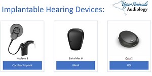 The difference between hearing aids and implanted hearing devices