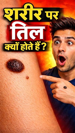 Why Do We Have Moles on Our Body? 🤔 | Amazing Skin Fact #shorts