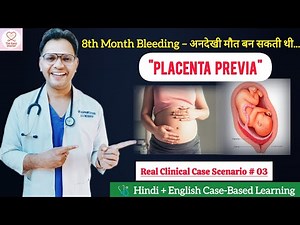Placenta Previa real clinical case scenario #03
