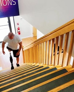 1.9K views · 372 reactions | Osseointegration allows amputees to wear a prosthesis for longer periods of time with greater comfort than a typical socket prosthesis, which in turn provides a better quality of life! | A Step Ahead Prosthetics | Facebook