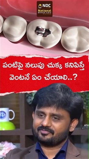 పంటిపై నలుపు చుక్క వస్తే ఏం చేయాలి || What To Do If Tooth Decay Starts? || NDC