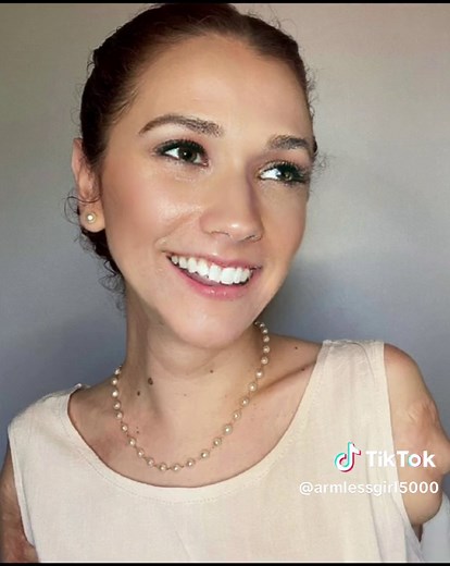 Empowering Stories of an Armless Amputee Girl