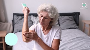 Treatments for atopic dermatitis - Sharecare