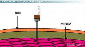 Intramuscular Injection: Definition, Administration & Complications