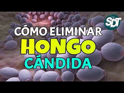 😱 Cómo ELIMINAR el HONGO CÁNDIDA 👩 3 Remedios NATURALES para COMBATIR la cándida albicans ♀️♂️