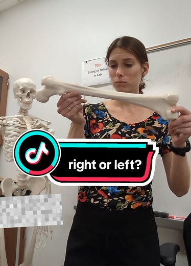 Identifying Right vs Left Femur: Anatomy Tutorial