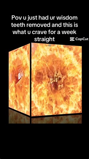 2016 Nissan Maxima Platinum (@2016.nissan.maxima)’s videos with Goo Goo Gaga - IcyJackz