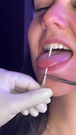 Classy sassy tongue piercing ✨ #toguepiercing #piercing #bodymods #mirrdopiercings #piercinglovers #piercingstudio @xfl95x