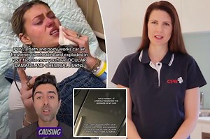 Doctor sounds the alarm after popular car accessory explodes in driver’s face