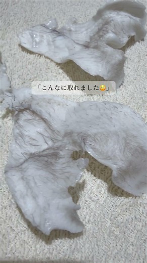 一瞬で印象が変わる耳毛脱毛