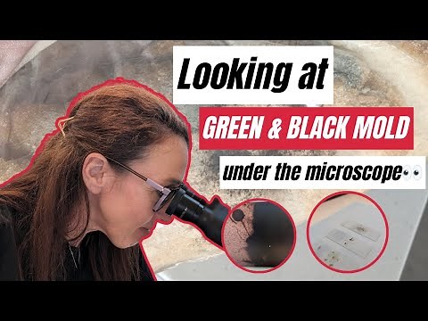 Mold Under the Microscope😱🔬