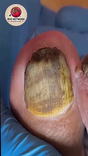 5.3K views · 44 reactions | Dry cuticle support ideas that soften overall nail appearance ❣ #HomeNailHabits #SoftCareRoutine #DailyComfortCare | Bye | Facebook