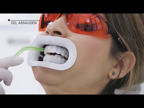 fläsh. Zahnaufhellung - Schritt für Schritt