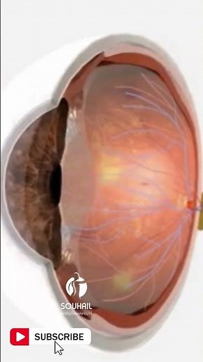 Unlocking Laser Photocoagulation : How It Saves Vision