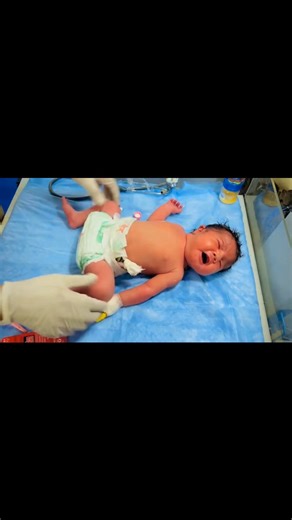 Abdominal Distension in Newborn Baby | Micronemia Management in NICU #babycare #baby #nicucare #babyrecovery #Newborn #nicubaby #viralvideochallenge In this video, we explain abdominal distension in newborn babies and its association with micronemia in the NICU. Learn the causes, symptoms, and management steps for better neonatal care. This video is helpful for doctors, nurses, and parents to understand the importance of timely intervention in neonatal intensive care.#NICUCare #NewbornHealth #Ab