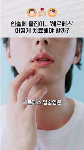 입술에 올라오는 물집 '헤르페스' 빨리 낫는 방법은?