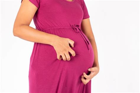 rasa gatal saat kehamilan