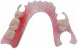 Pictures of Low Cost Denture Repair