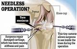 What Is The Recovery Time From Knee Replacement Surgery Images
