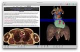 Photos of Human Anatomy Software For Medical Students