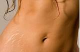Pictures of Can Makeup Cover Up Stretch Marks