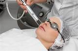 How Much Does Laser Skin Treatment Cost