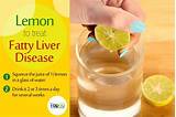 Photos of Lemon Treatment