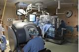 Davinci Robot For Hysterectomy Photos