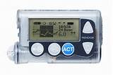 What Is An Insulin Pump Pictures