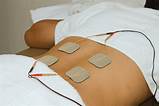 Photos of Transcutaneous Electrical Nerve Stimulation