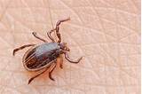 Medical Ticks Pictures