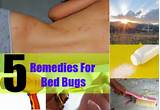 Bed Bug Treatment Natural Remedies