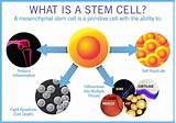Mesenchymal Stem Cells Treatment Images