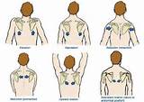 Images of Scapular Muscle Strengthening Exercises