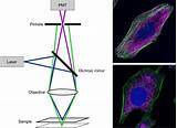 Pictures of Laser Confocal Microscope Resolution