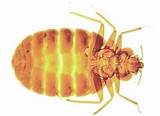 Images of The Best Pest Control For Bed Bugs