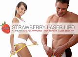 What Is Strawberry Laser Lipo Treatment