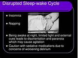 Pictures of Sleep Wake Disorder Treatment