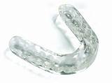 Orthodontic Sports Mouth Guard Photos