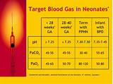 Cord Blood Gas Analysis Photos