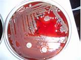 Blood Agar Plate Pictures