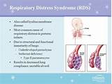 Respiratory Distress Syndrome Treatment Images