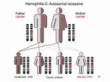 Images of Hemophilia A Carrier