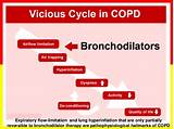 Treatment And Prevention Of Copd Images