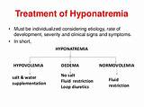 Treatment Of Hyponatremia In Chf